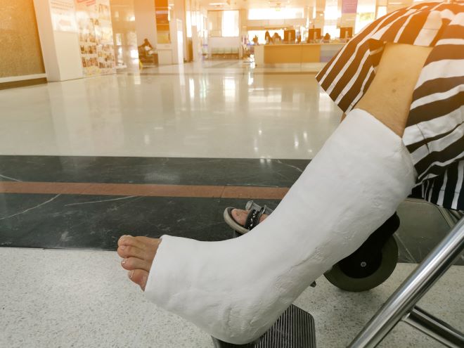 enkel en onderbeen verbonden in het gips